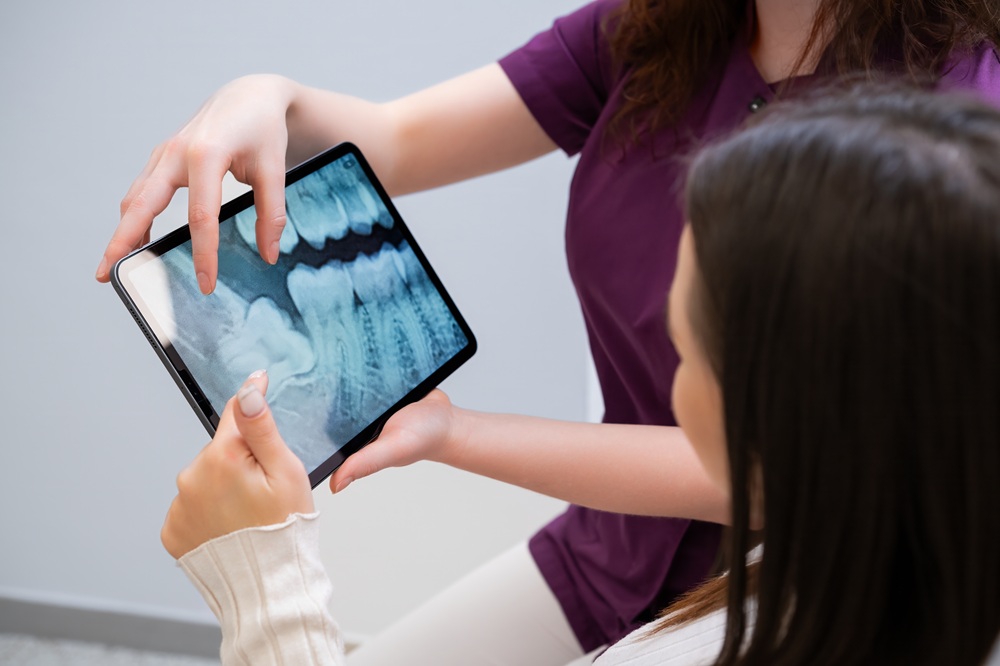 Dentist Reviewing Tooth Extraction X-Ray – Extractions A dentist discusses a digital X-ray on a tablet with a patient, explaining the extraction process and ensuring a clear understanding of treatment. – Extractions