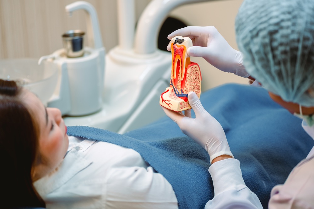 Dentist Explaining Root Canal Procedure – Root Canals A dentist shows a detailed tooth model to explain the root canal process, demonstrating how infected pulp is removed to save the tooth. – Root Canals