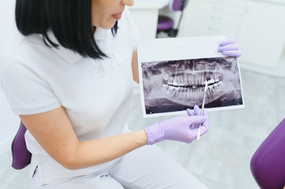 A dentist examines a panoramic X-ray film, pointing out details of the teeth and jaw to explain treatment options and oral health findings. – Panoramic X-Ray