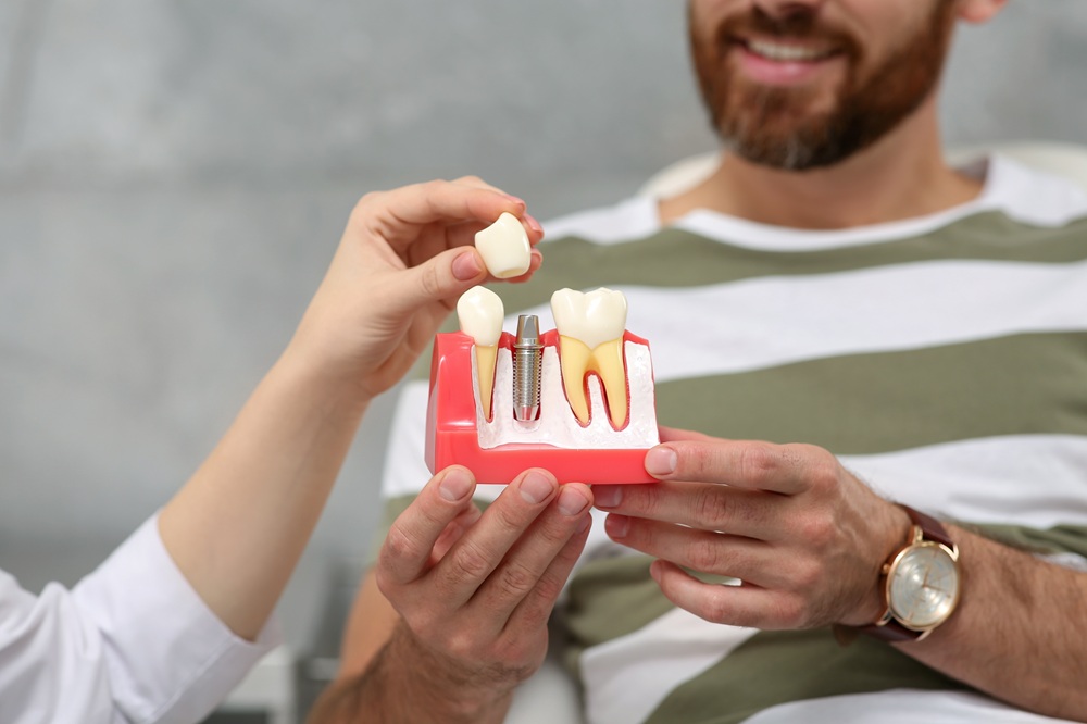 A dentist shows a patient a detailed model of a dental implant, demonstrating how titanium posts replace missing teeth for long-lasting, natural-looking results. – Dental Implants