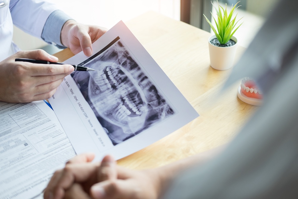 A dentist reviews a patient’s panoramic dental X-ray during a consultation, highlighting precise diagnostic imaging for comprehensive oral care. – Panoramic X-Ray